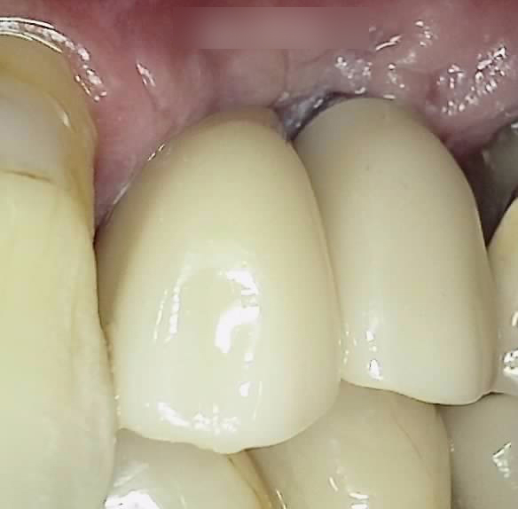 Treatment case image 7