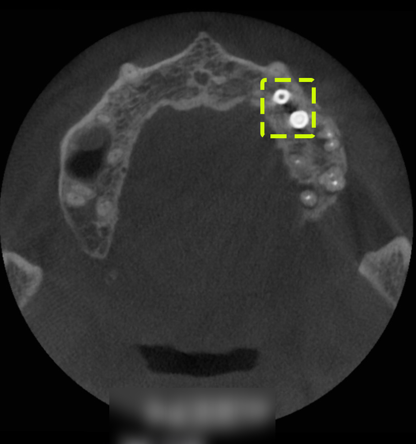 Treatment case image 8