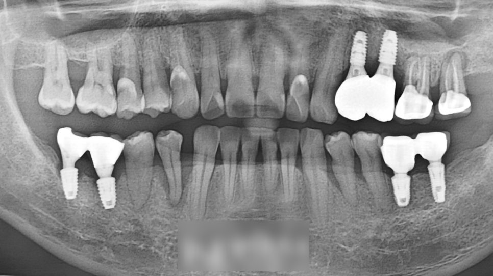 Treatment case image 12
