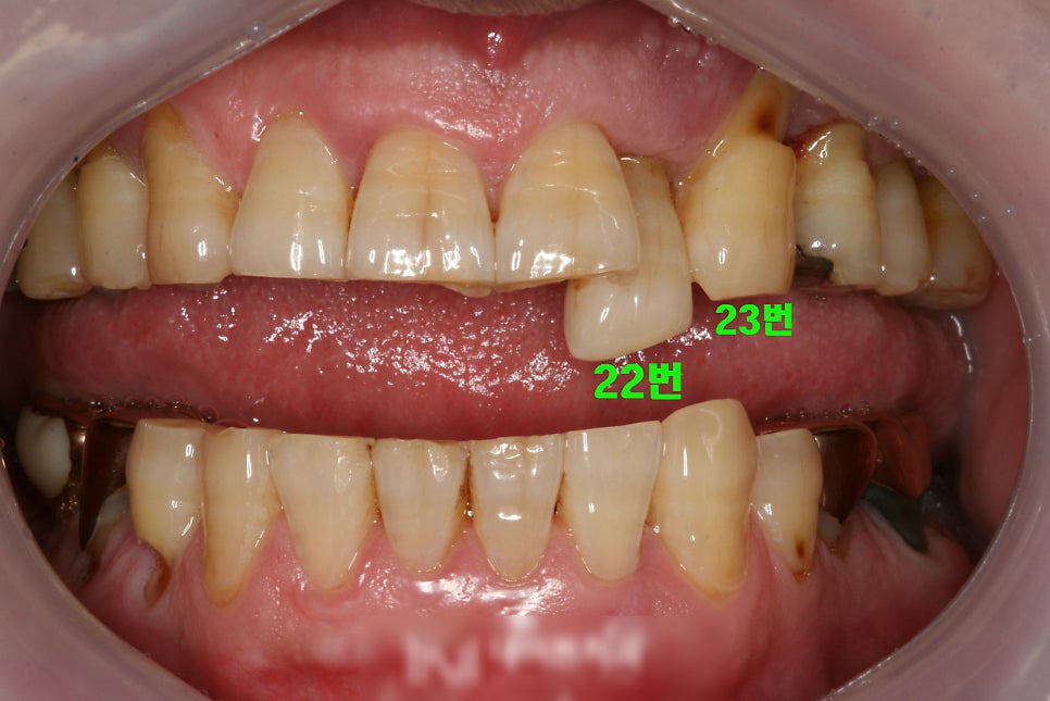 Treatment case image 1