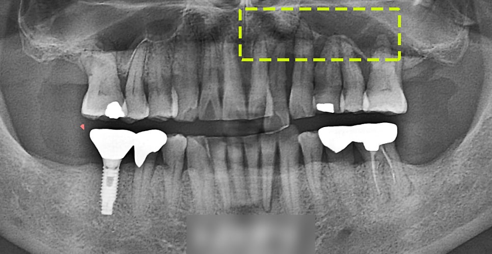 Treatment case image 2