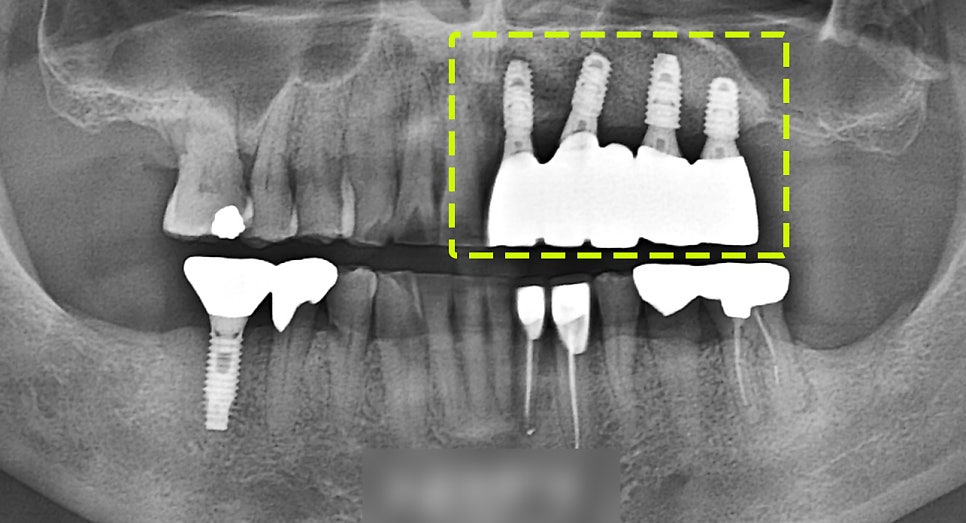 Treatment case image 5