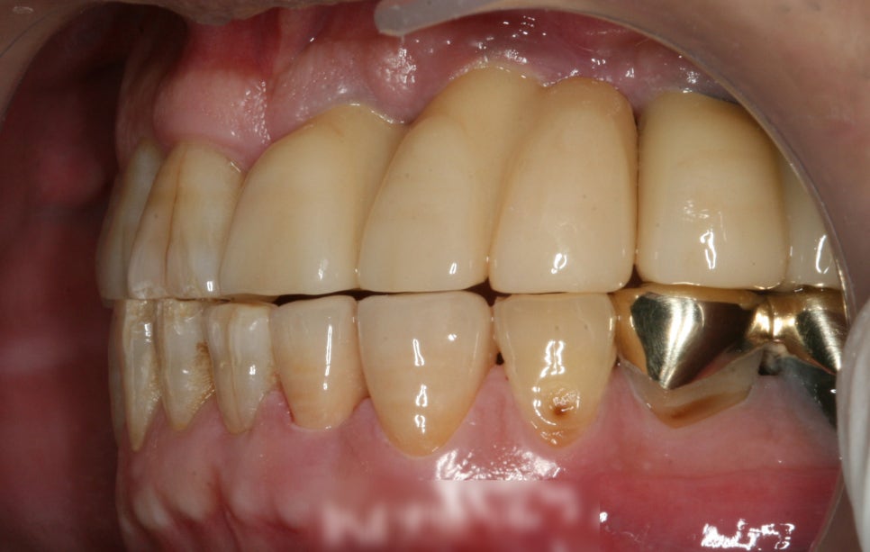 Treatment case image 6