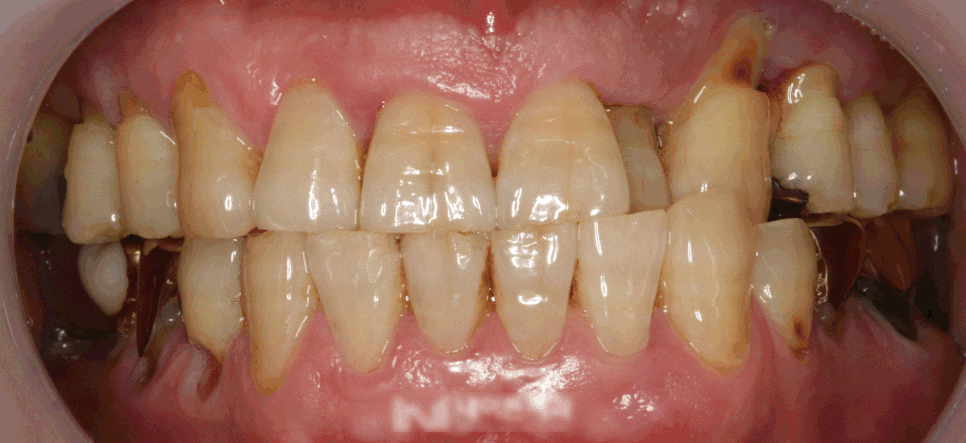 Treatment case image 7