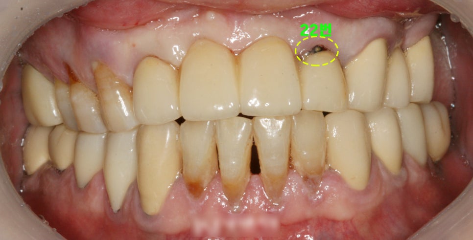 Treatment case image 1
