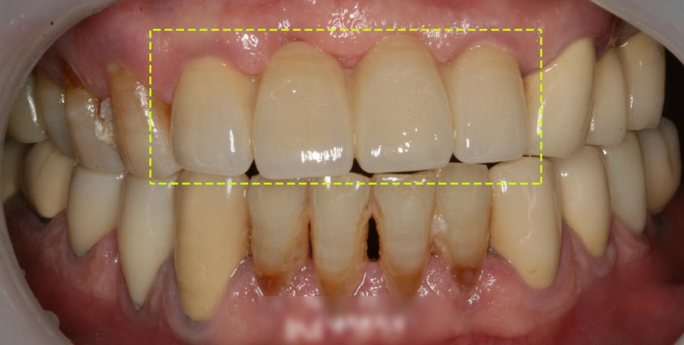 Treatment case image 3