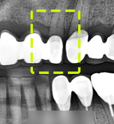 Treatment case image 4