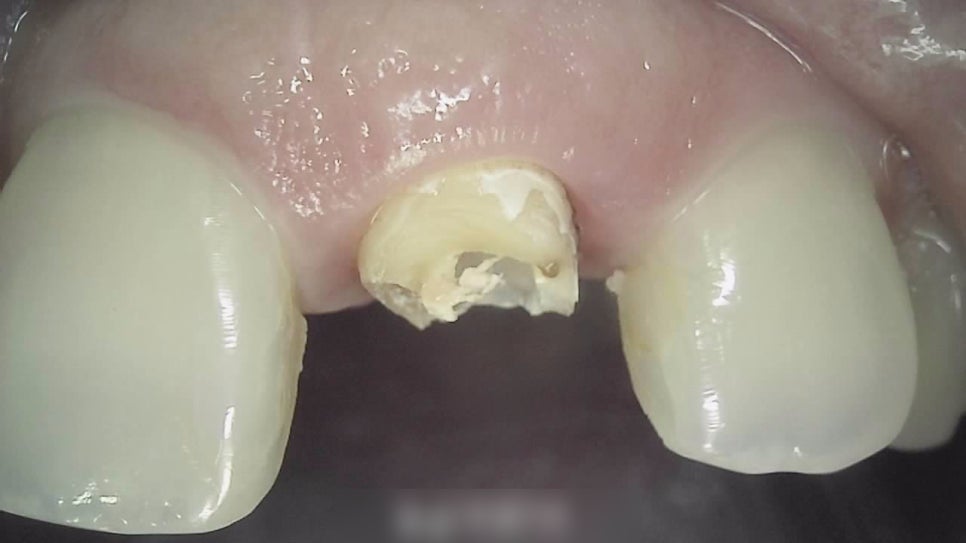 Treatment case image 1