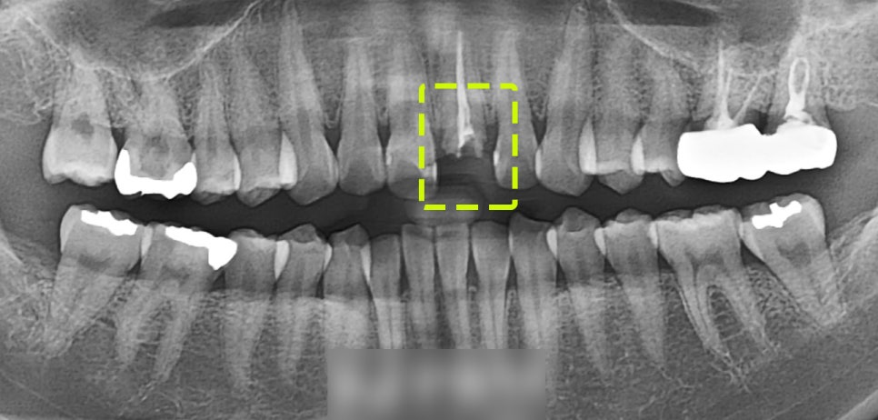 Treatment case image 2