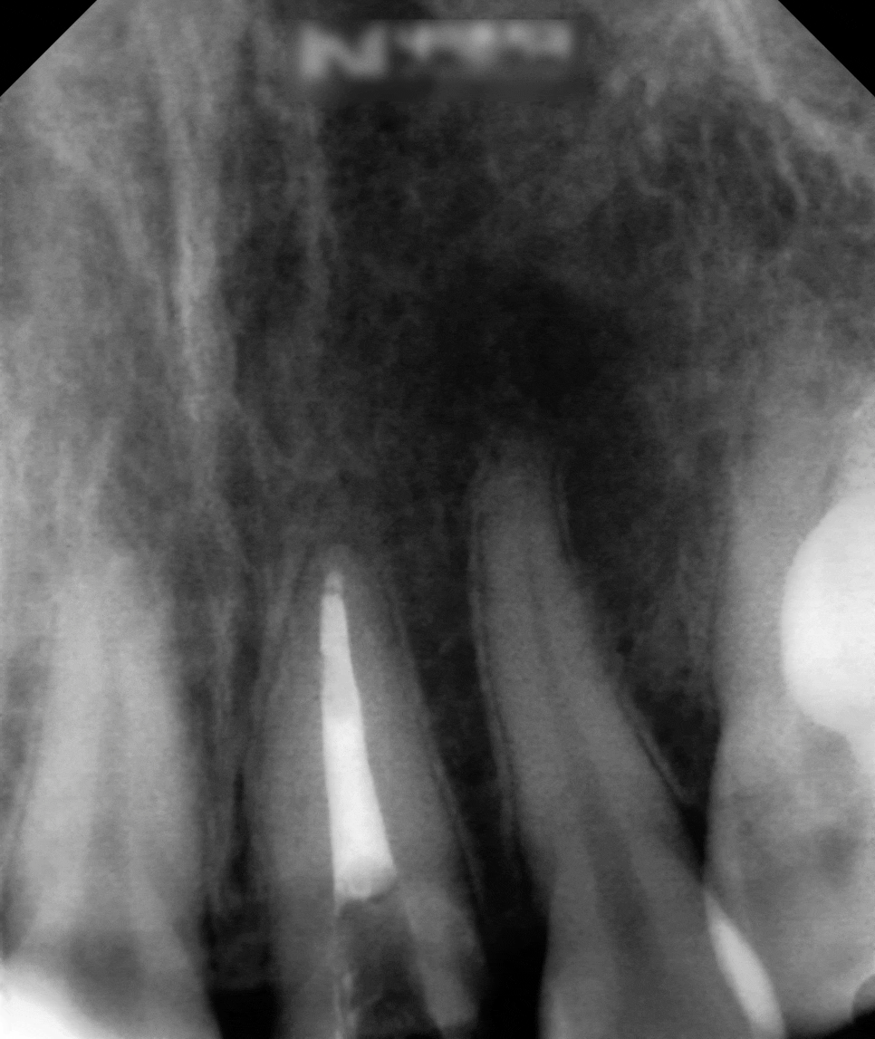 Treatment case image 3