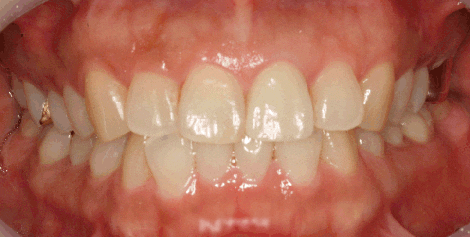 Treatment case image 4