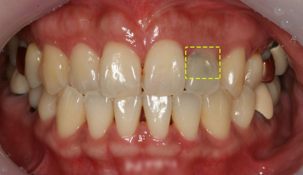 Treatment case image 1