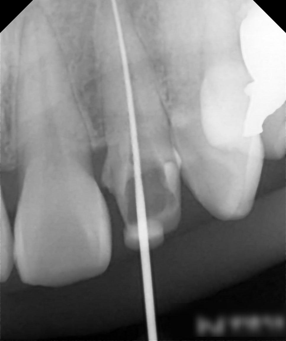 Treatment case image 3