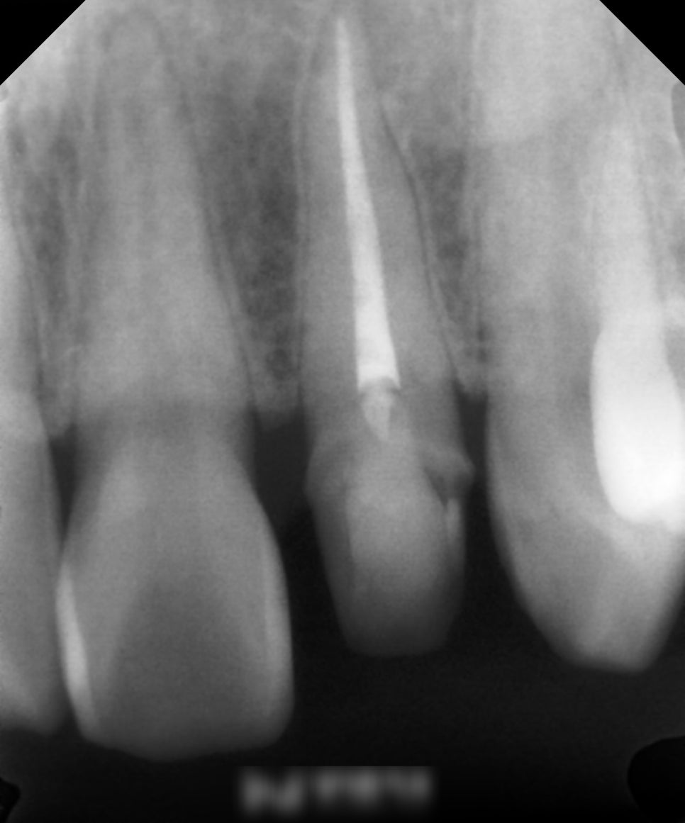 Treatment case image 5