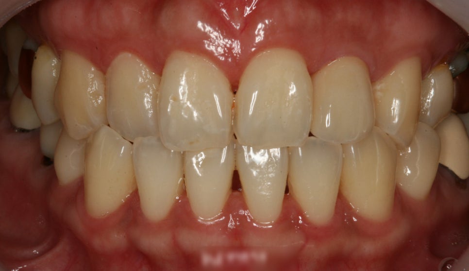 Treatment case image 6