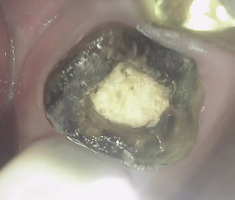 Treatment case image 1