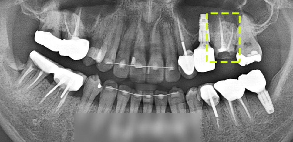 Treatment case image 2