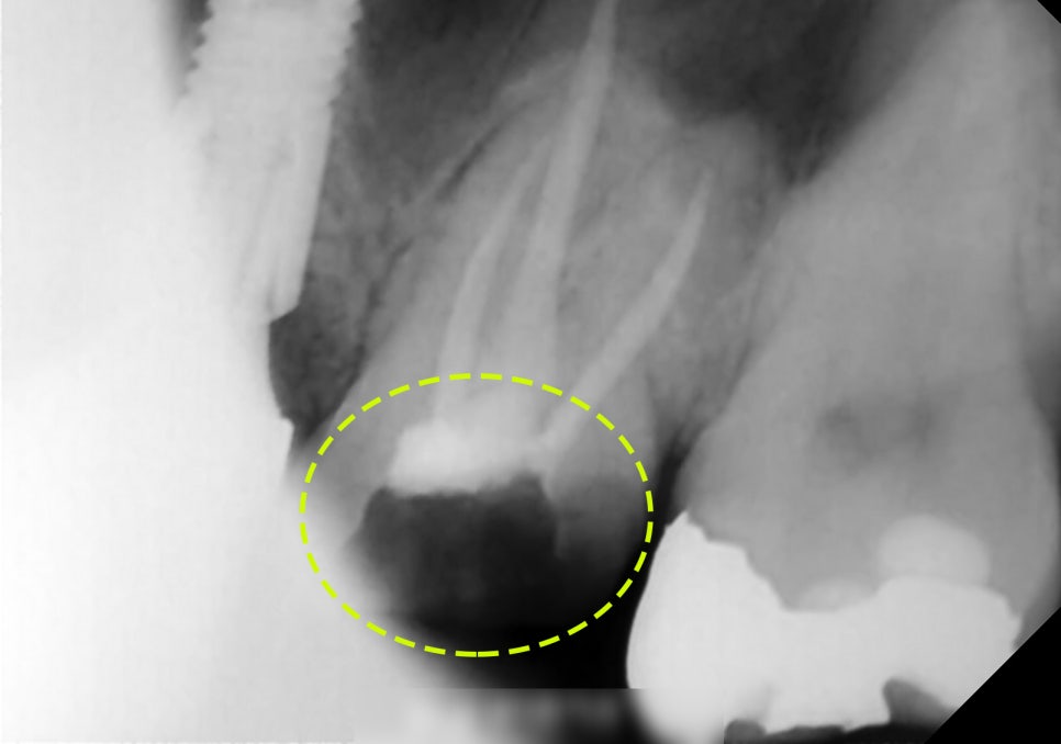 Treatment case image 3