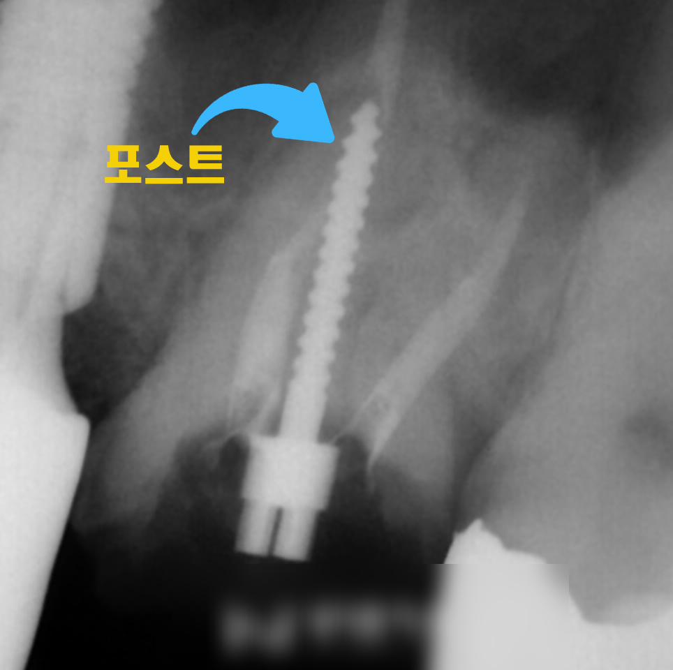 Treatment case image 4
