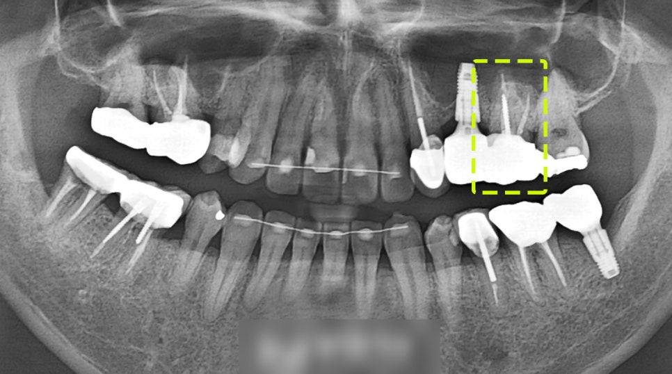 Treatment case image 9