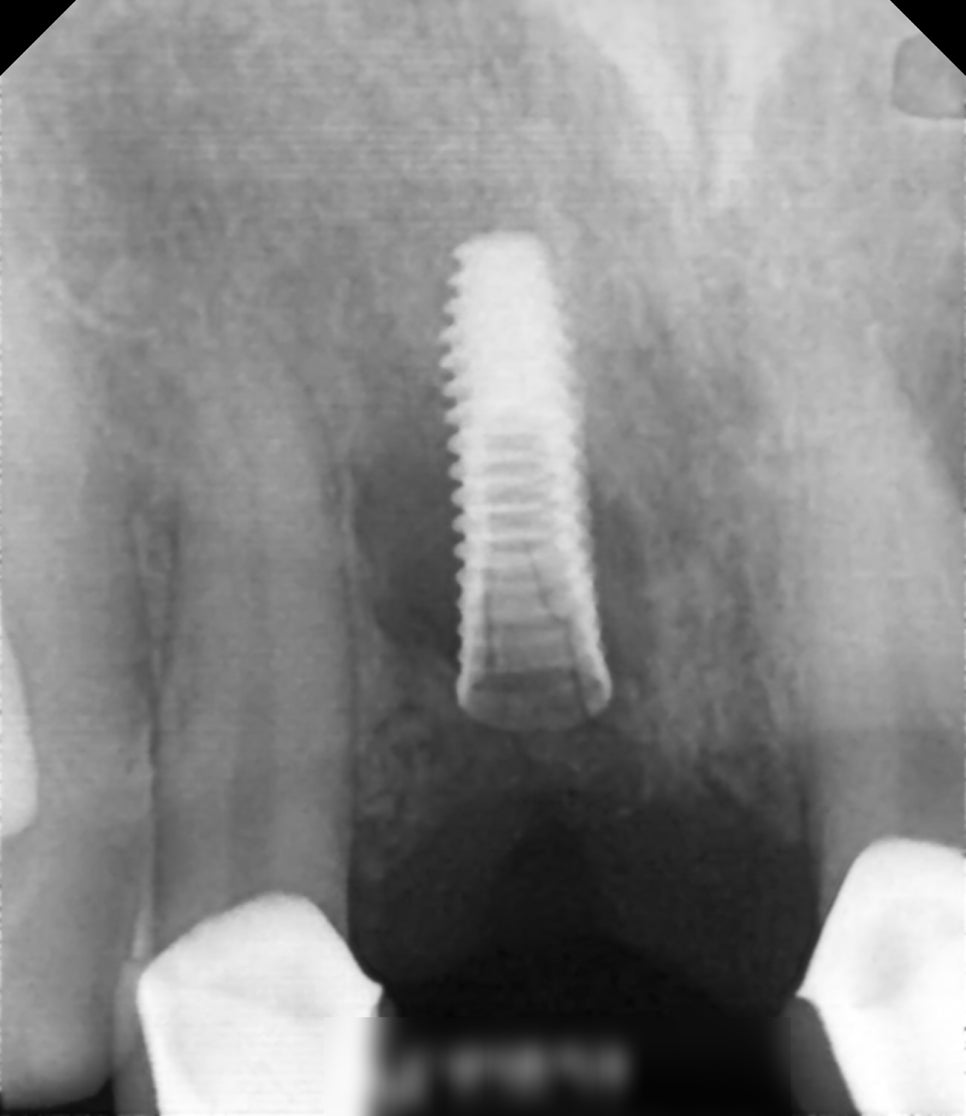Treatment case image 1