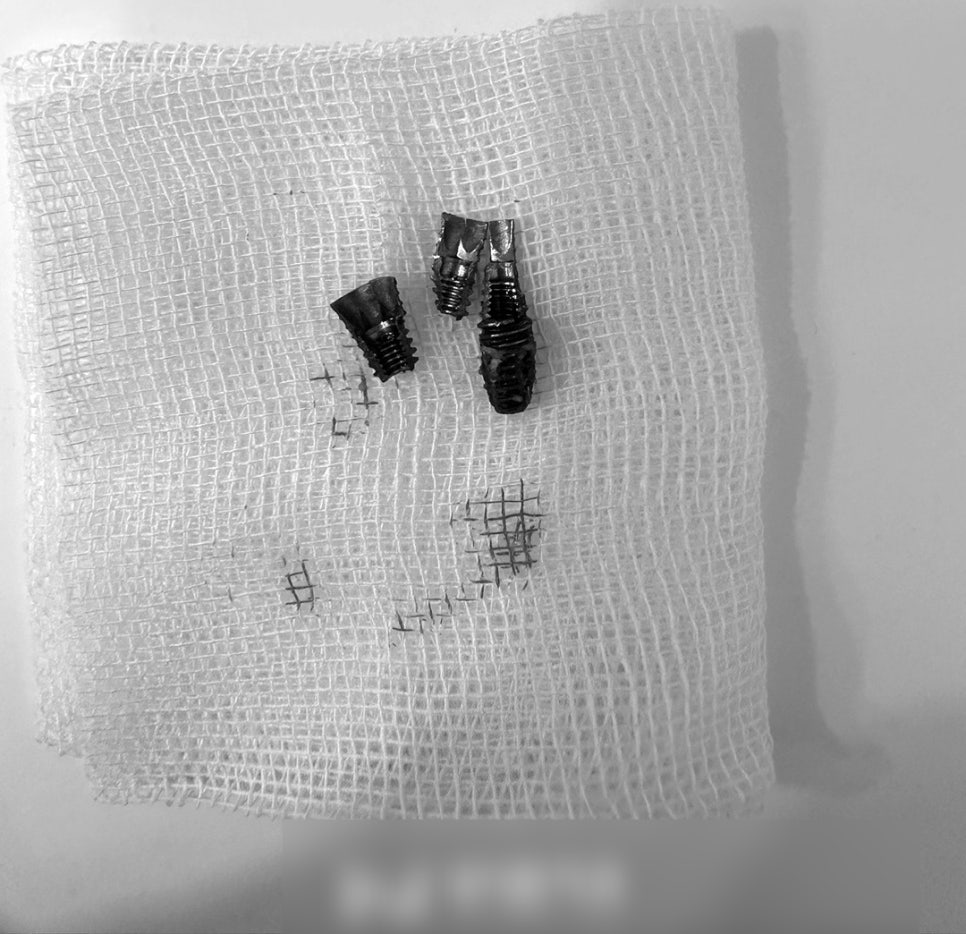 Treatment case image 3
