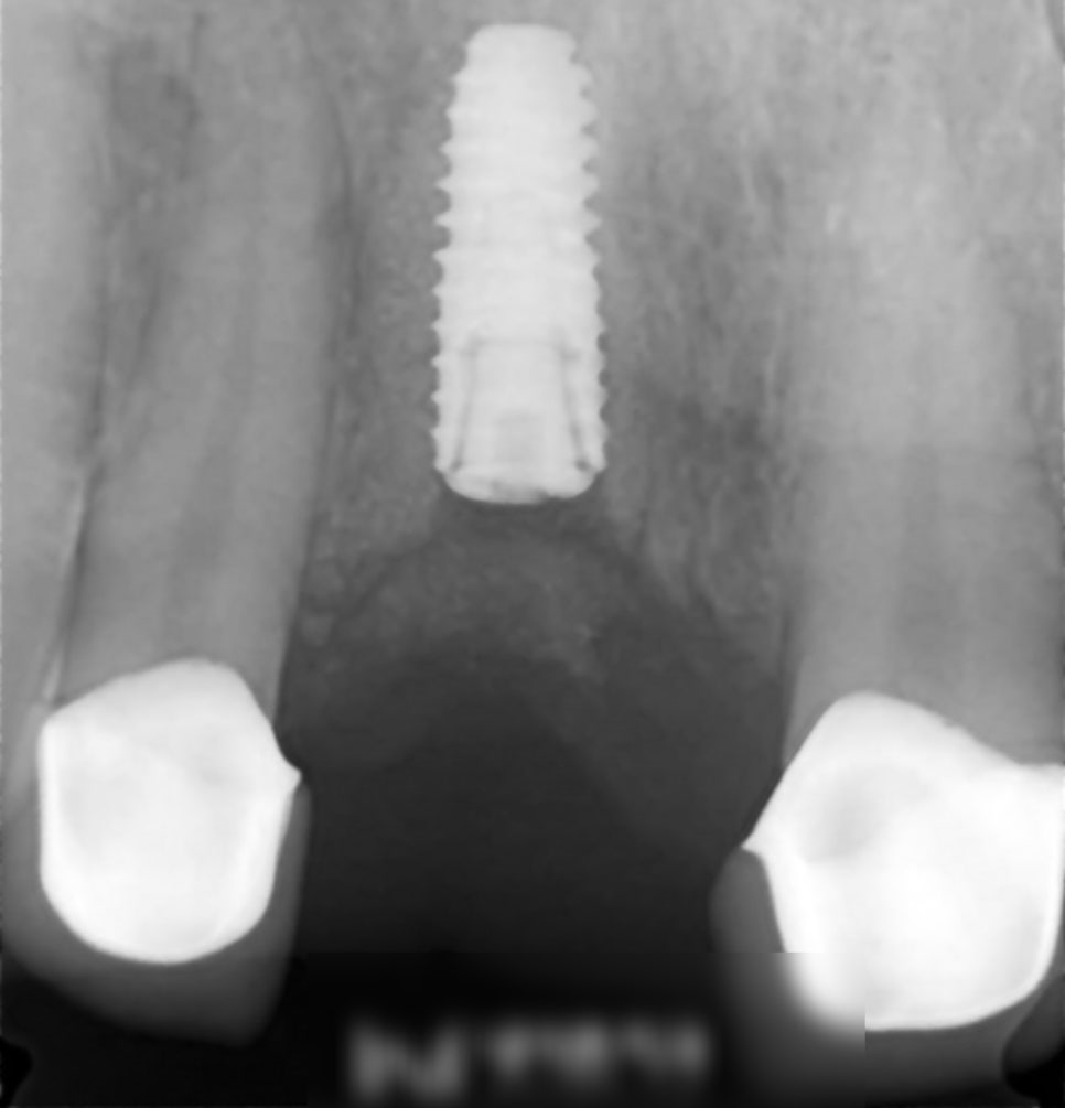 Treatment case image 4