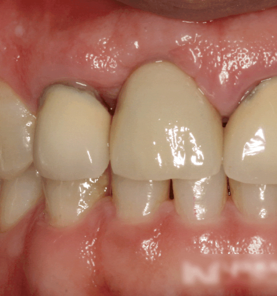 Treatment case image 5