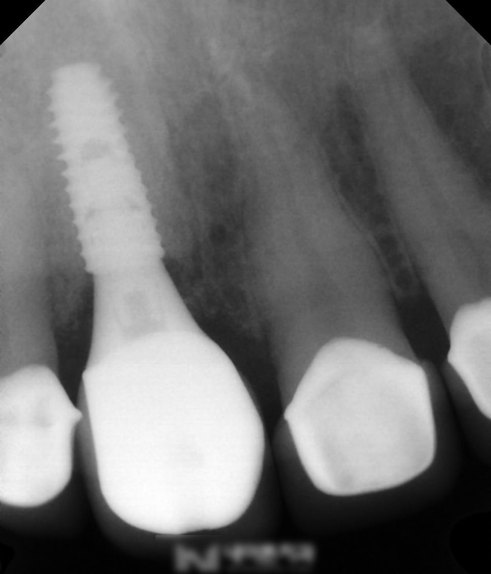 Treatment case image 6