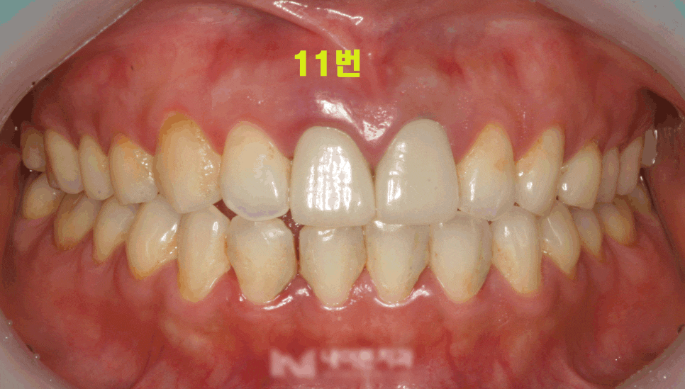 Treatment case image 1