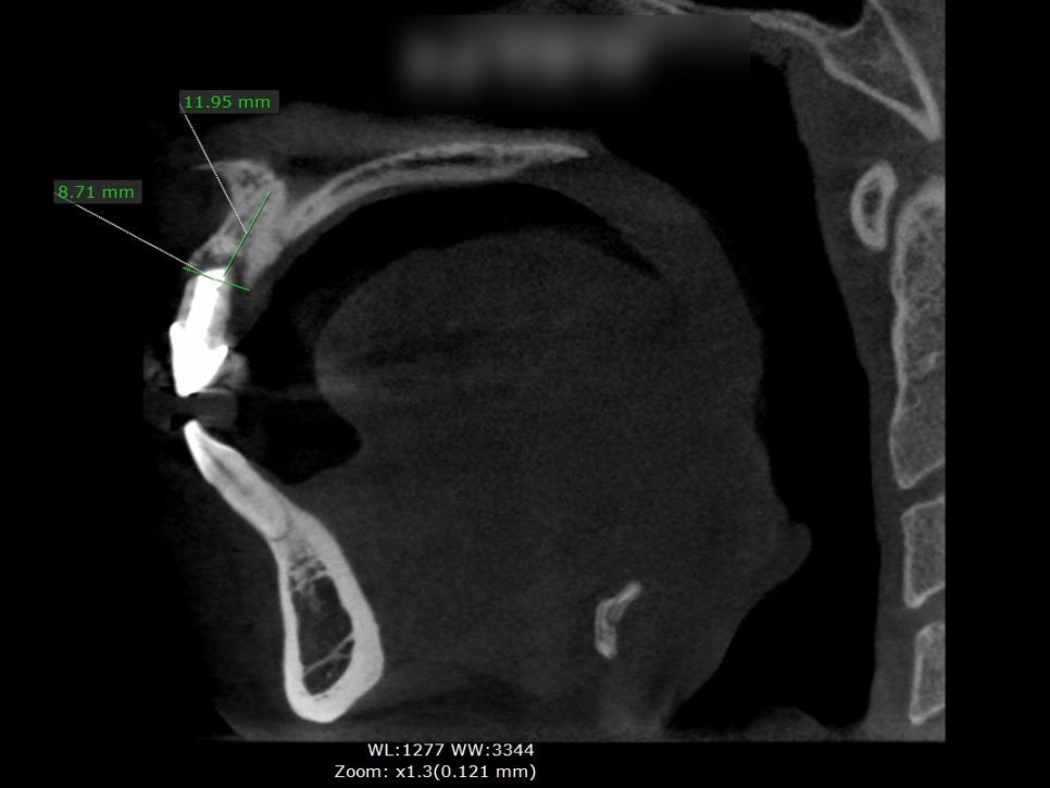 Treatment case image 4