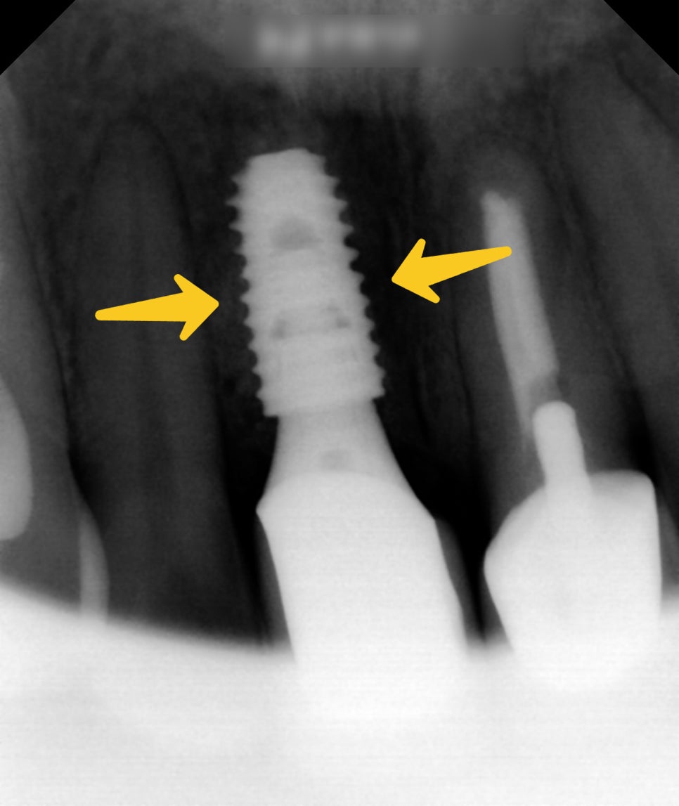 Treatment case image 5