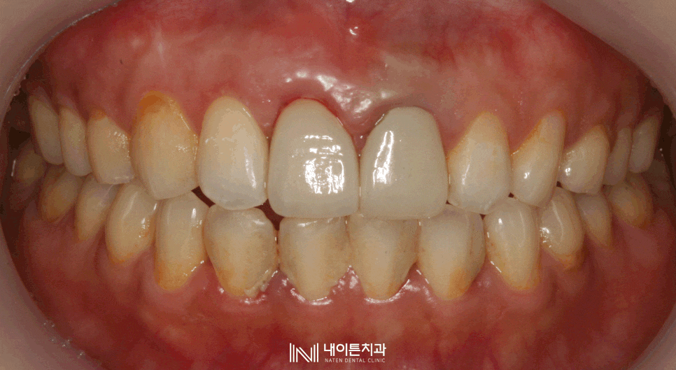 Treatment case image 8