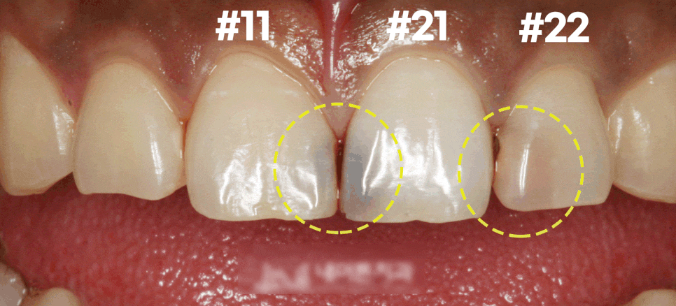 Treatment case image 1