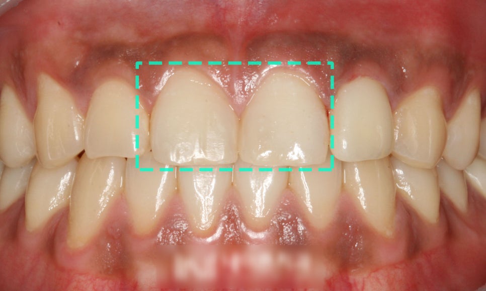 Treatment case image 3