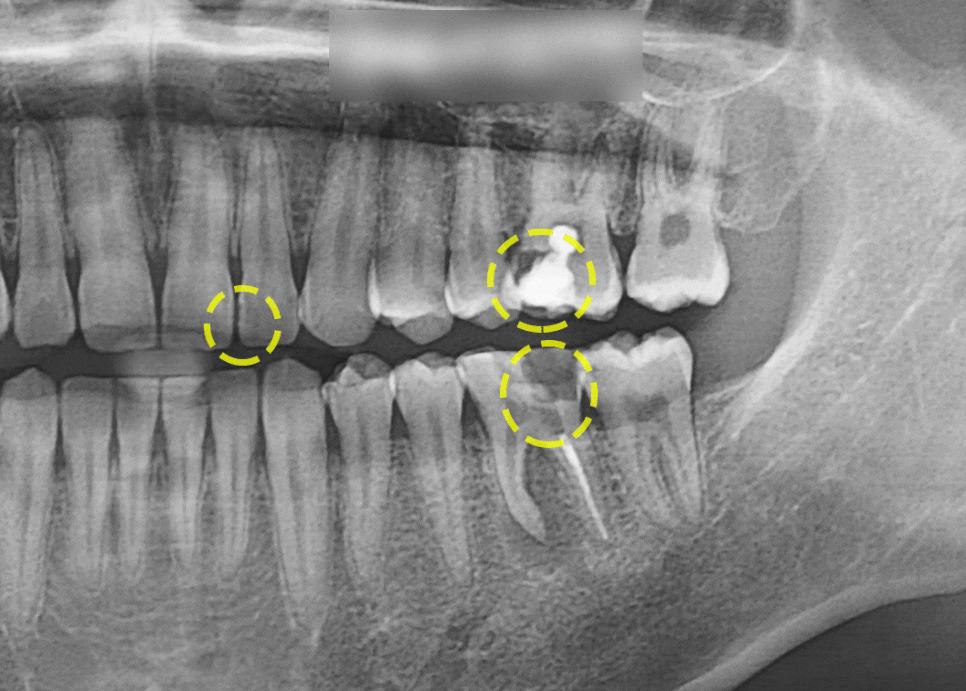 Treatment case image 4