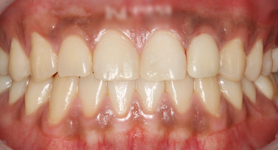 Treatment case image 7