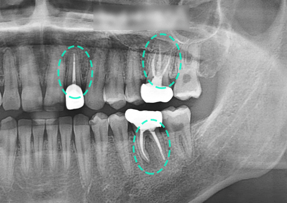 Treatment case image 8