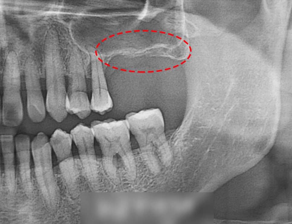 Treatment case image 1