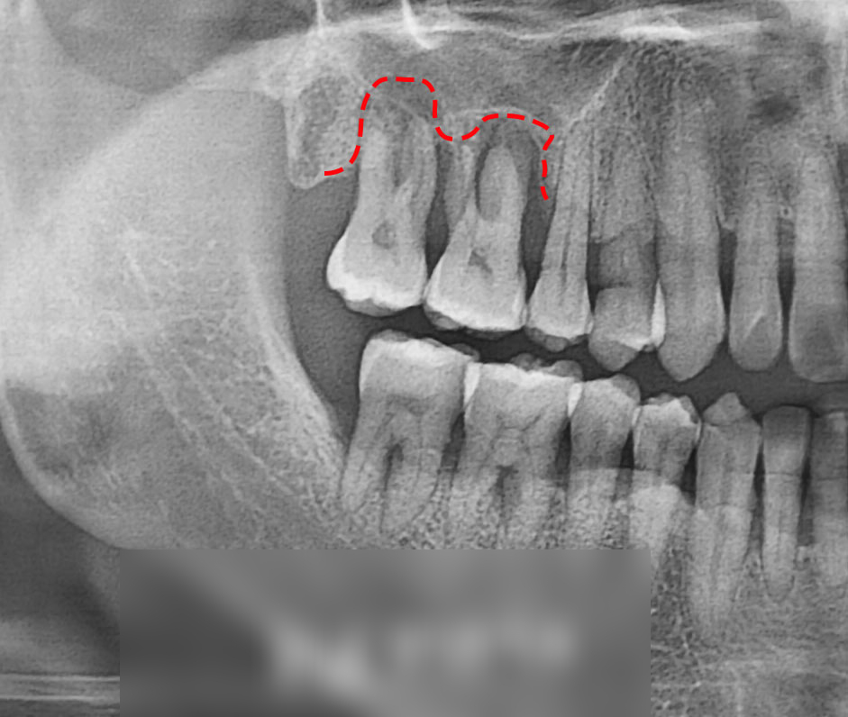 Treatment case image 3