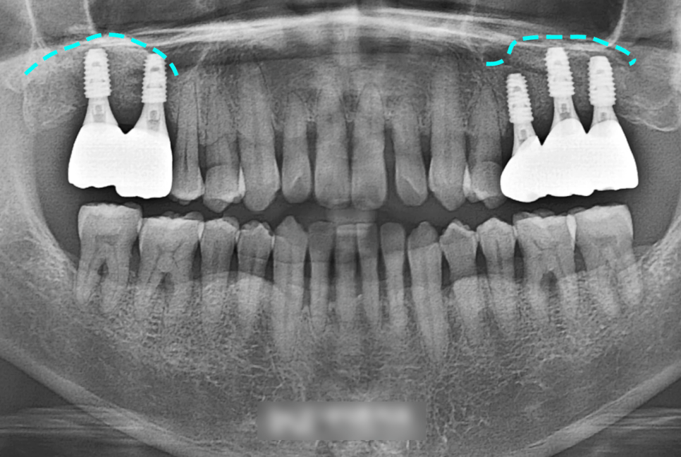 Treatment case image 4