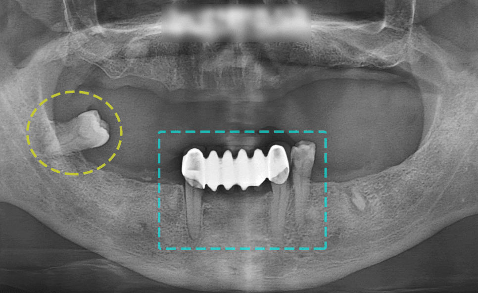 Treatment case image 1