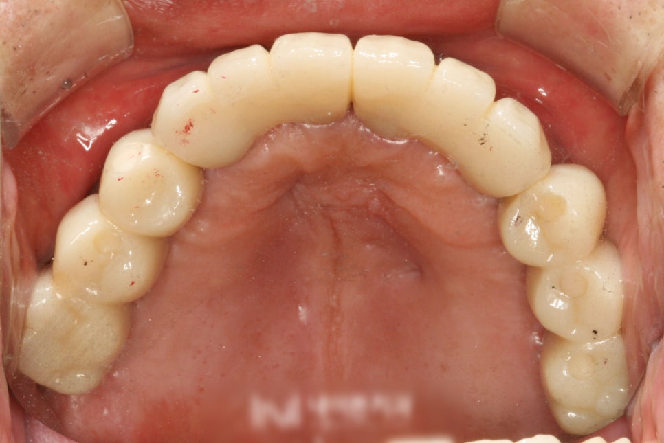 Treatment case image 3