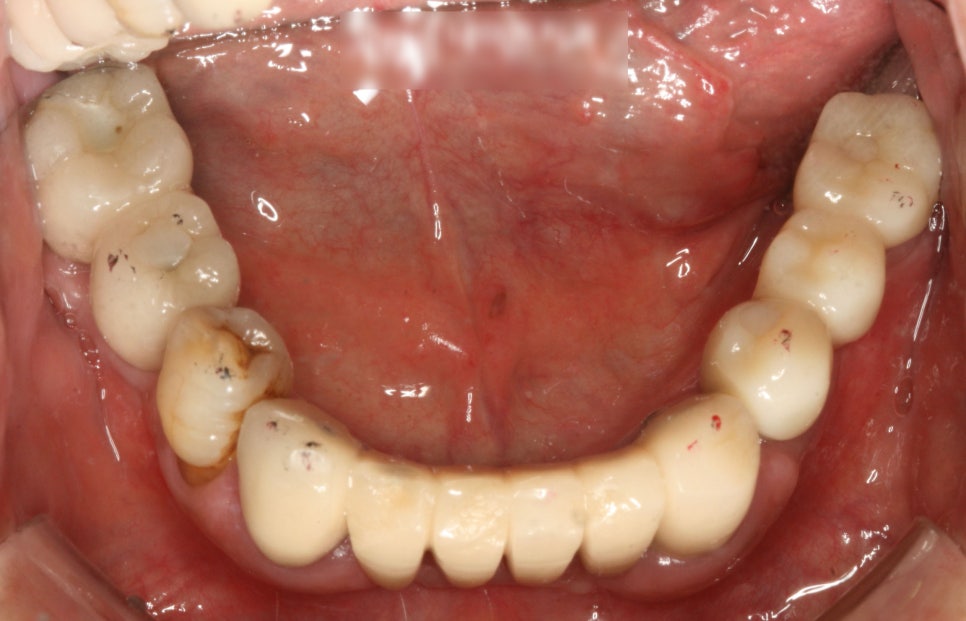 Treatment case image 4
