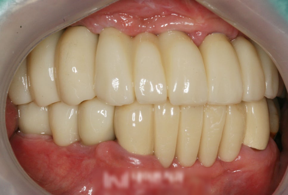 Treatment case image 7