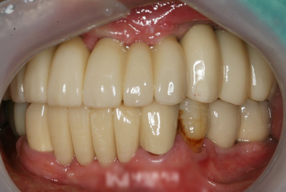 Treatment case image 8
