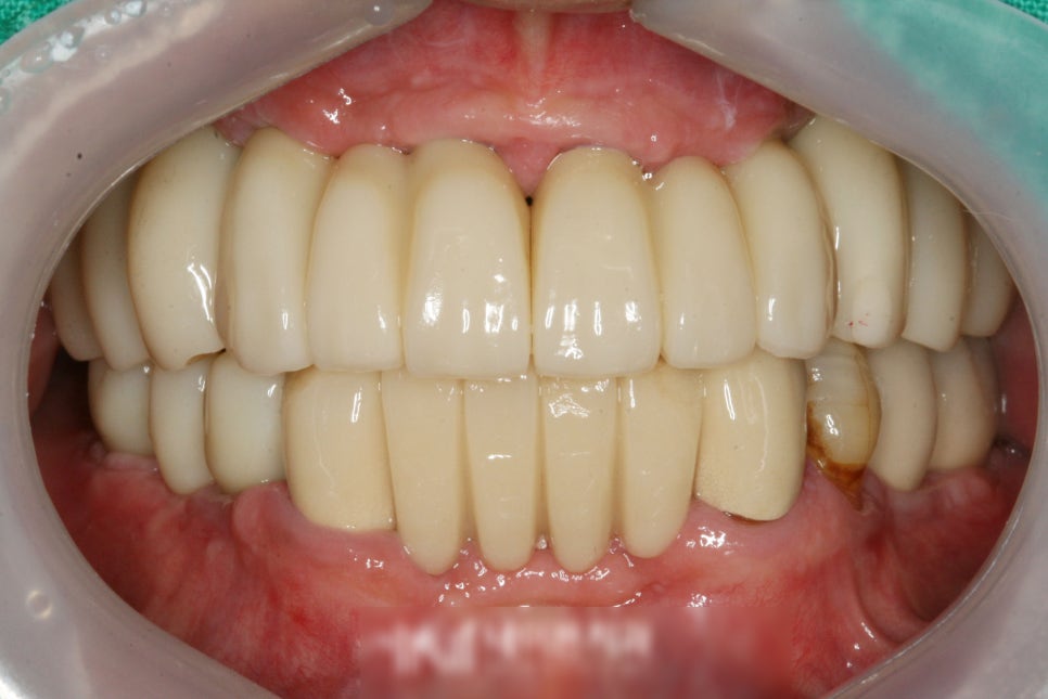 Treatment case image 9