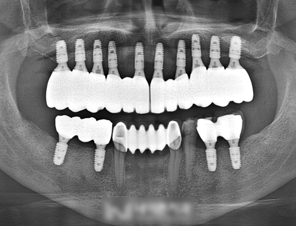 Treatment case image 2
