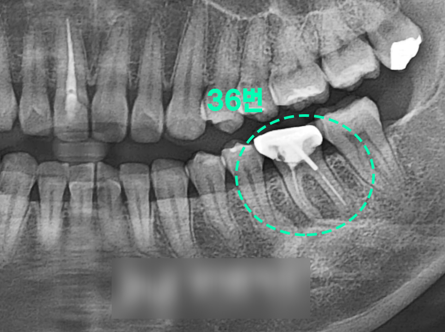 Treatment case image 1