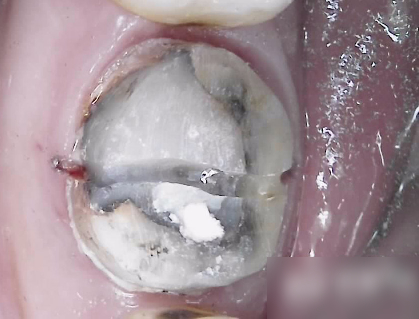 Treatment case image 3
